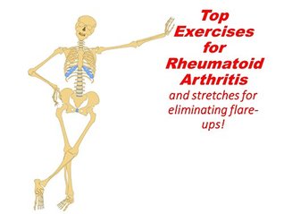 Full Download Top Exercises for Rheumatoid Arthritis and Stretches for eliminating Flare-ups! - Danialle Steel file in ePub