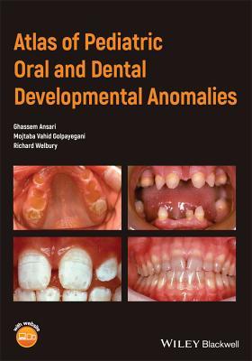 Read Atlas of Pediatric Oral and Dental Developmental Anomalies - Ghassem Ansari file in ePub